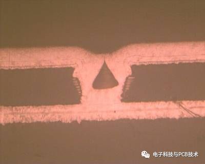 IC载板及HDI 导通孔Undercut 介绍